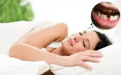 mơ thấy răng bị rụng