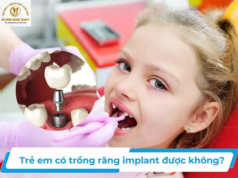 mơ thấy rụng hết răng không chảy máu