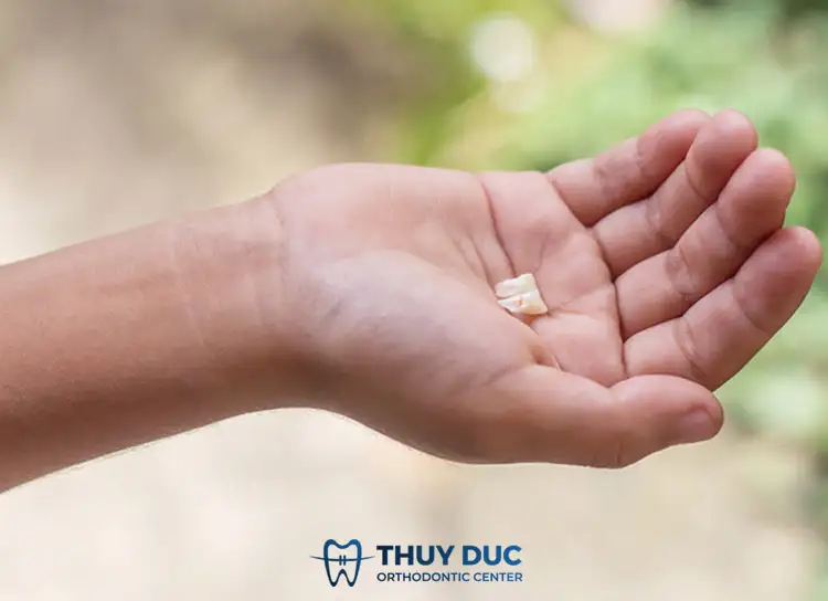 Nằm Mơ Gãy Răng Cửa: Giải Mã Điềm Báo, Ý Nghĩa Tâm Linh & Khoa Học Toàn Diện