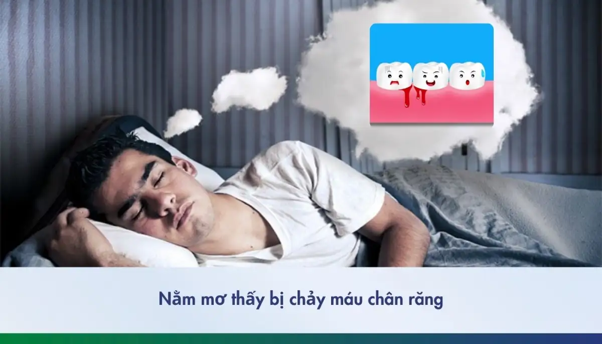 mơ thấy răng rụng không chảy máu