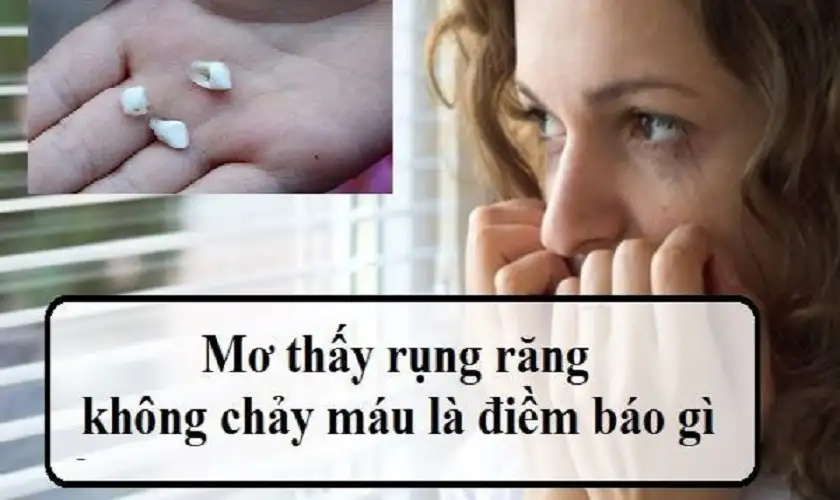 mơ rụng răng nanh