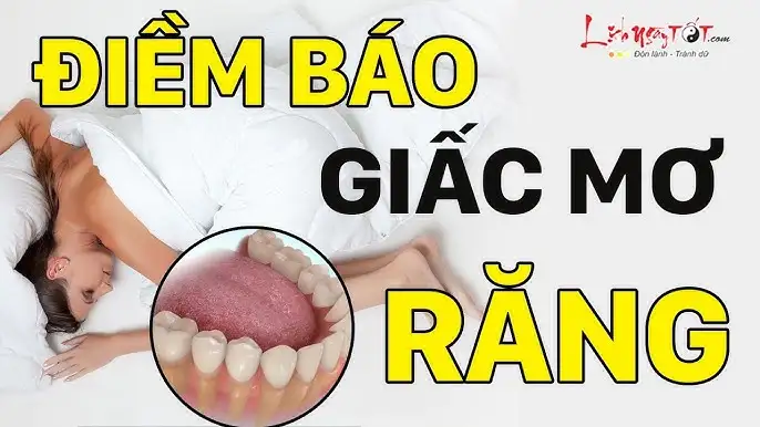 mơ thấy mình bị gãy răng