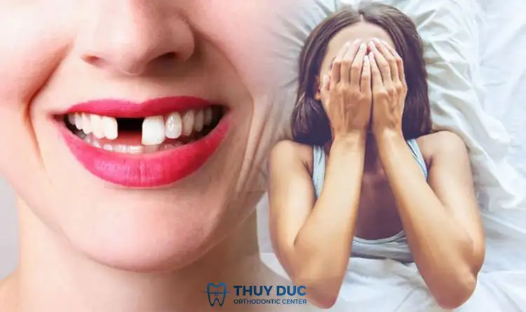 mơ bị rụng răng hàm dưới