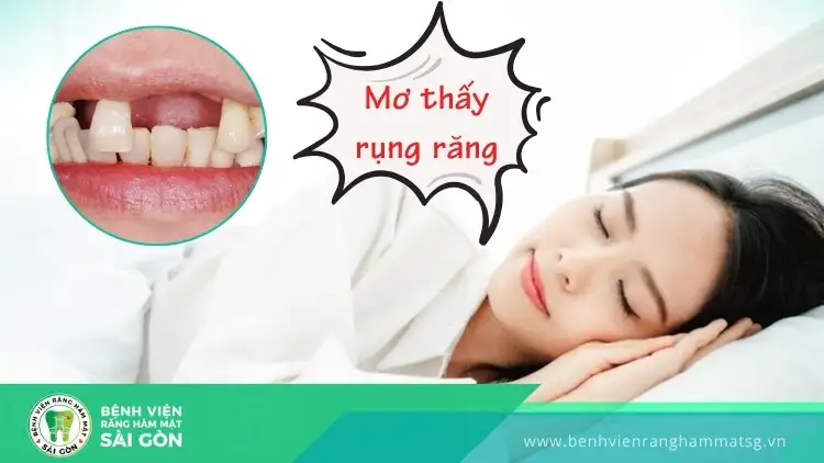 Mơ thấy rụng răng số mấy