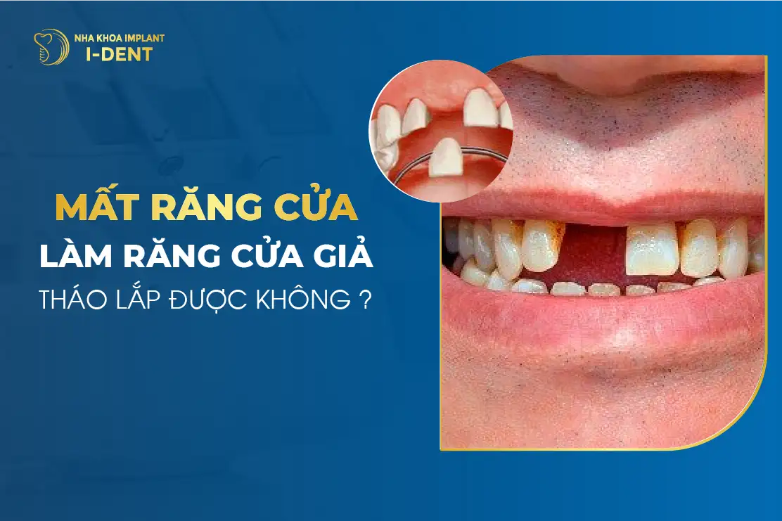 nằm mơ rụng răng cửa