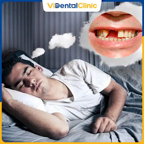 nằm mơ mất răng