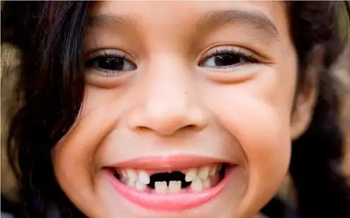 Nằm Mơ Thấy Bị Rụng Răng: Giải Mã Điềm Báo, Ý Nghĩa Sâu Sắc & Con Số May Mắn