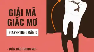 nằm mơ bị rụng răng chảy máu