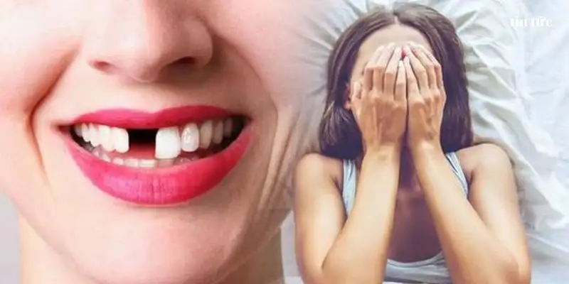 mơ thấy rụng hết răng