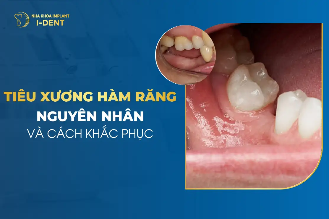 nằm mơ thấy hàm răng giả