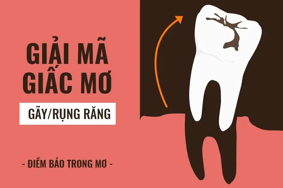 mơ rụng răng chảy máu