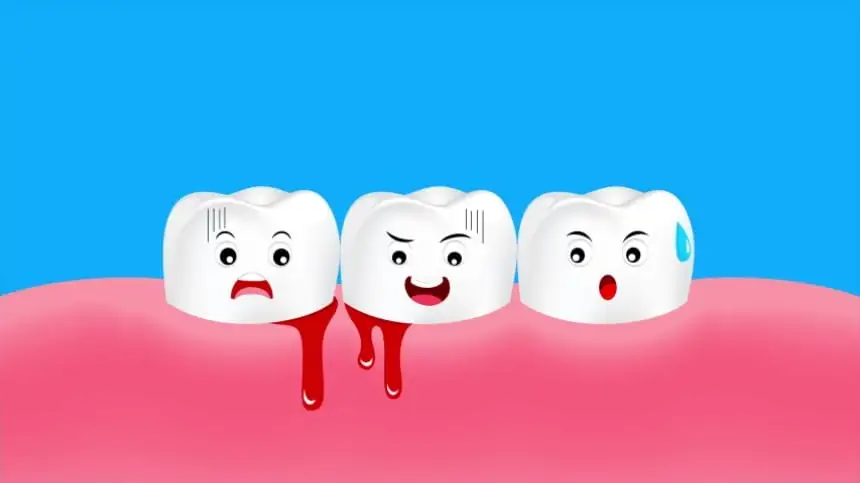 nằm mơ gãy răng chảy máu