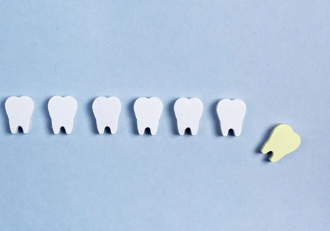 mơ thấy bị rụng răng hàm trên