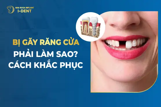 mơ gãy răng cửa hàm dưới